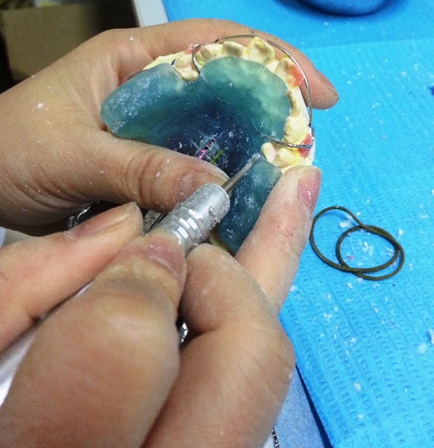 hàm TwinBlock trong Labo